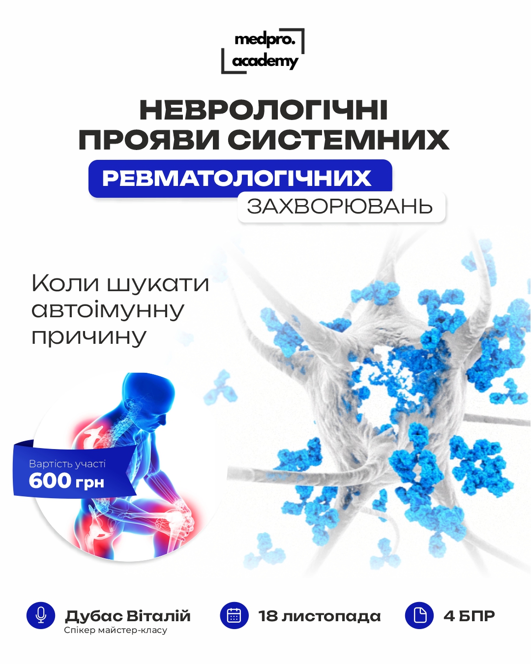 3Неврологічні прояви системних ревматологічних захворювань коли шукати автоімунну причину